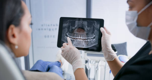 Licensed Teeth Whitening service in Springfield, CO - Smile Center Dentistry
